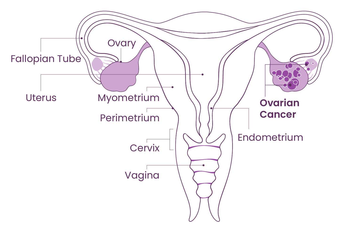 Diagram of a female reproductive system