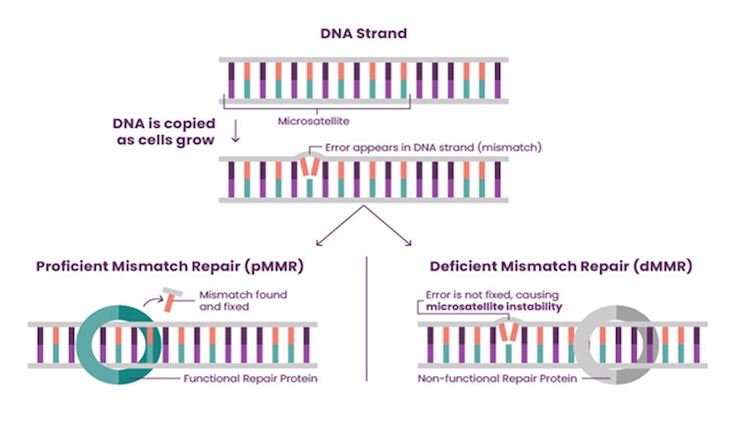 How mismatch repair (MMR) works during DNA copying and cell growth: proficient MMR (pMMR) corrects copying errors, while deficient MMR (dMMR) causes errors to build up, leading to microsatellite instability (MSI), a biomarker linked to endometrial cancer